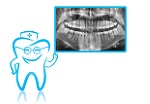 Dental Xray in Scarborough Toronto